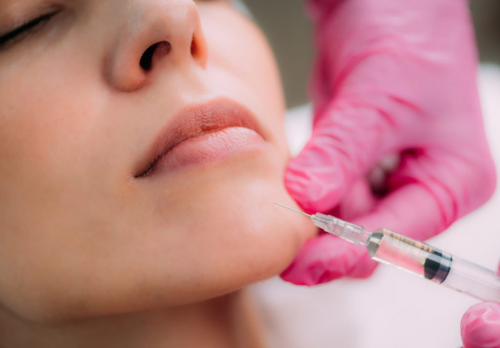 Close-up on a woman's face showing the injection of Chin-and-jaw-injections